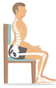 lordosis diagram