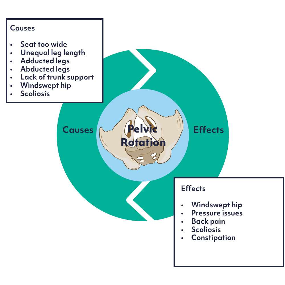 causes and effects of pelvic rotation