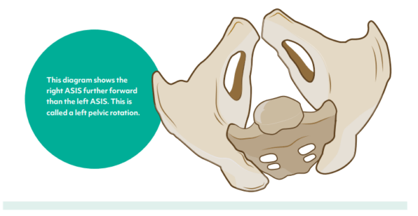 Finding the Best Seating for Cerebral Palsy - Vivid Care