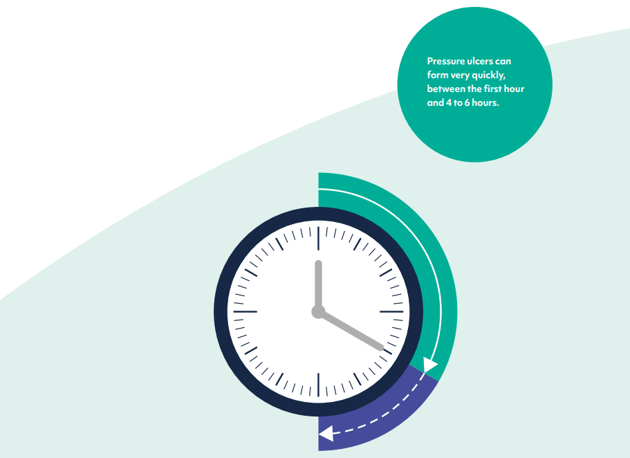 illustration showing that pressure ulcers can form quickly.
