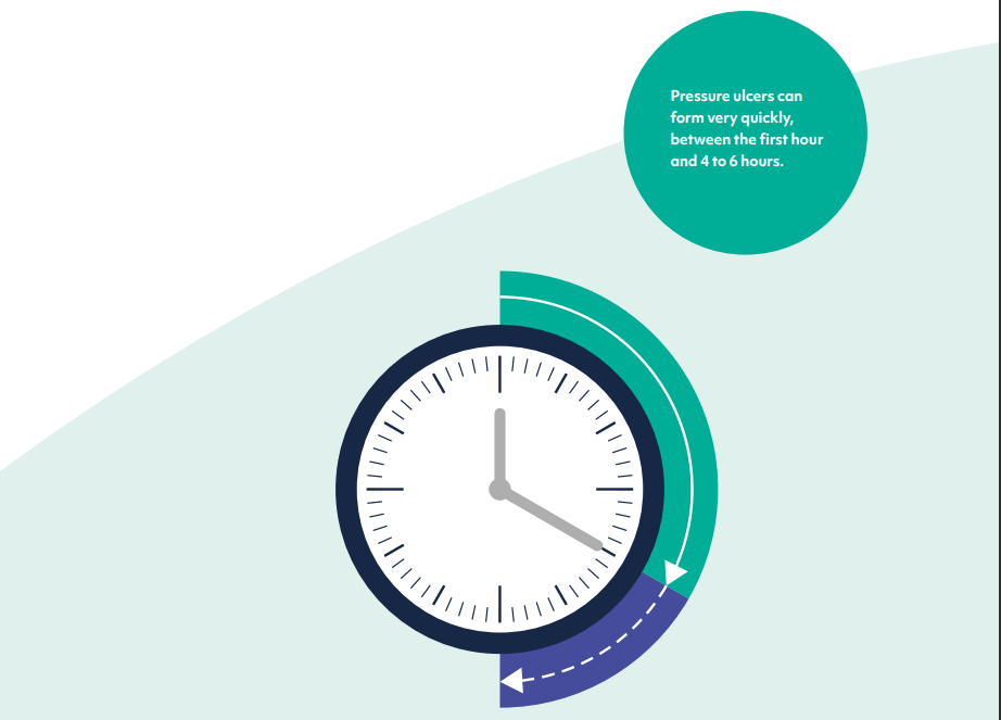 illustration showing that pressure ulcers can form quickly.