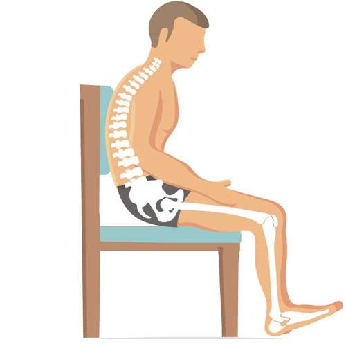 Kyphotic spine diagram