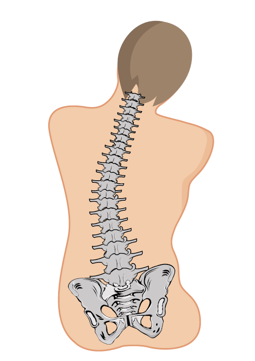 Pelvic Obliquity Diagram