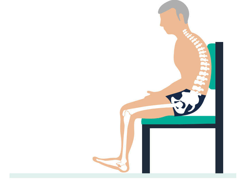 man with a kyphotic spine sitting in a chair