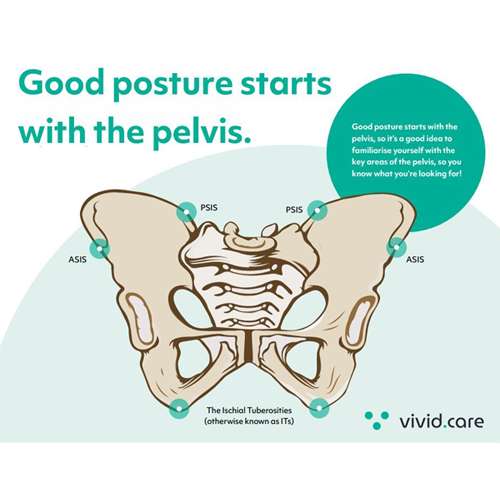 the importance of correct pelvic positioning in seating