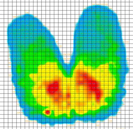 Pressure mapping image of a person sitting in a chair.