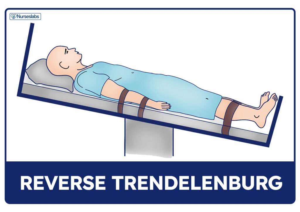 Anti-trendelenburg position