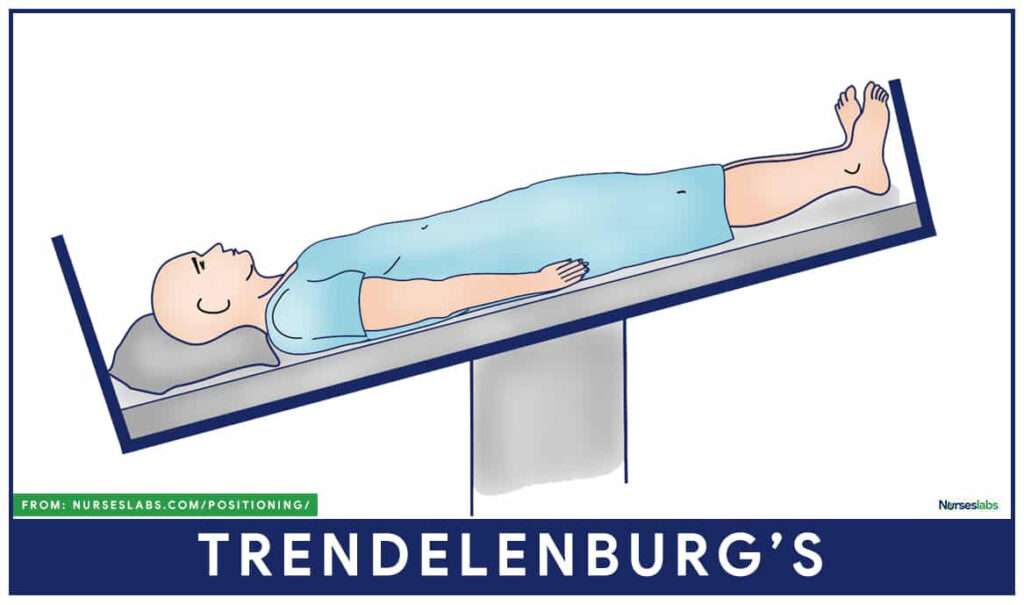 Trendelenburg position
